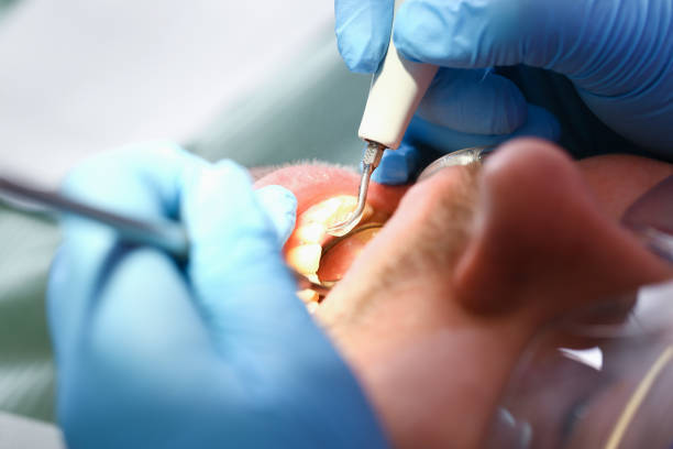 Best Emergency Gum Treatment in Nocona, TX